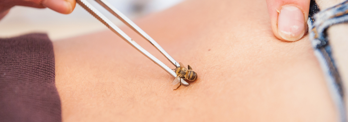 HONEYBEES: A STING THAT CURES?