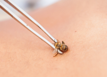 HONEYBEES: A STING THAT CURES?