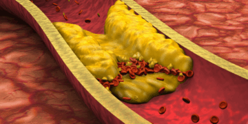 CHOLESTEROL AND STATINS: A MYTH IN NEED OF A REALITY CHECK? AN INDUCTIVE PARADIGM CHALLENGE!